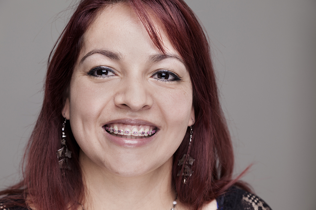 Portrait:  Head shot of mid-adult female wearing braces.